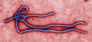 A colorized transmission electron micrograph of the Ebola virus. 