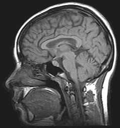 Human brain image.